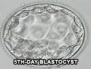 5 day blastocyst