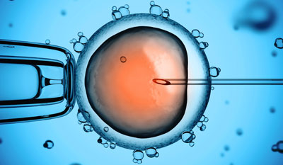cryopreservation