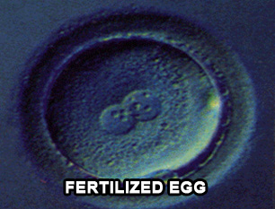 fertilized egg